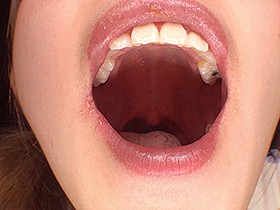 ベロフェラディルド　サンプル画像02